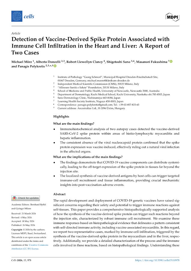 MDPI – Detection of Vaccine-Derived Spike Protein Associated with Immune Cell Infiltration in the Heart and Liver