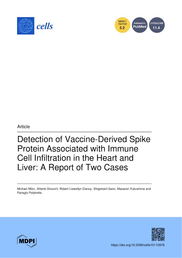 Cells – Detection of Vaccine-Derived Spike Protein Associated with Immune Cell Infiltration in the Heart and Liver