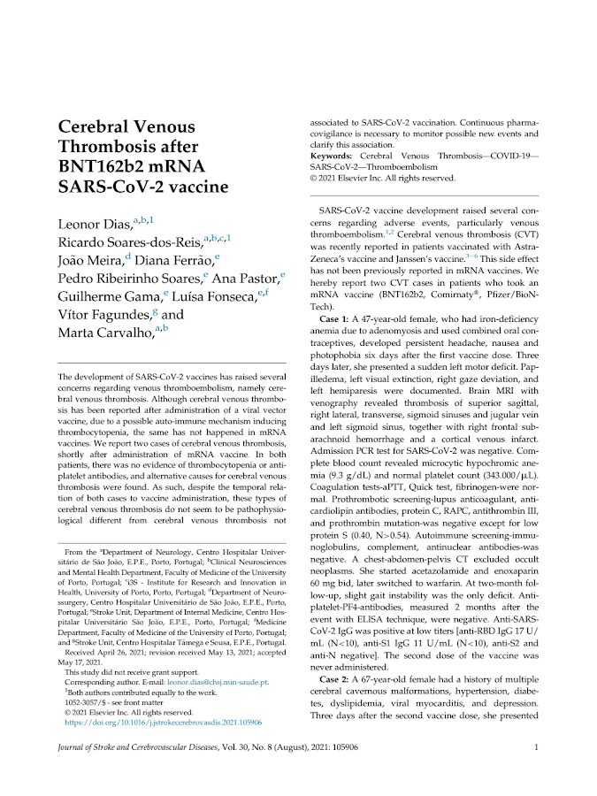 Journal of stroke and Cerebrovascular diseases – Cerebral Venous Thrombosis after BNT162b2 mRNA SARS-CoV-2 vaccine- PT