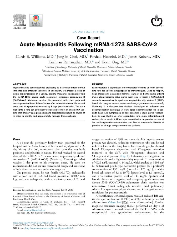 Elsevier – Acute Myocarditis Following mRNA-1273 SARS-CoV-2 Vaccination