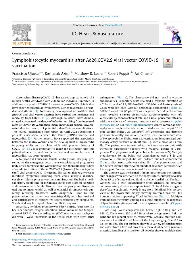 Elsevier – Lymphohistocytic myocarditis after Ad26.COV2.S viral vector COVID-19 vaccination