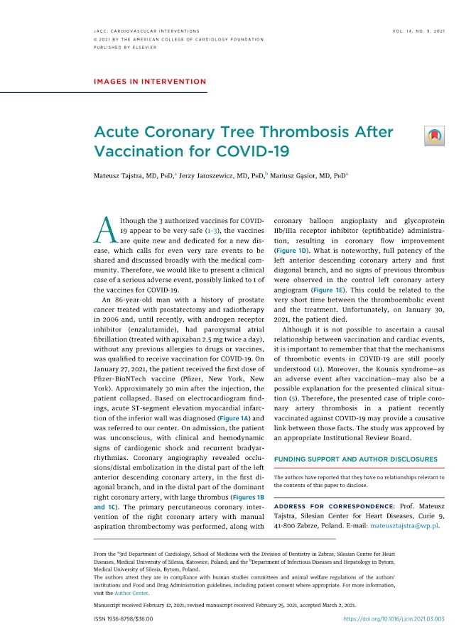 JACC – Acute Coronary Tree Thrombosis After Vaccination for COVID-19