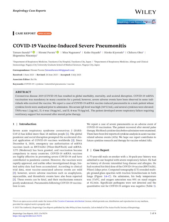 Respirology Case Reports – COVID- 19 Vaccine- Induced Severe Pneumonitis