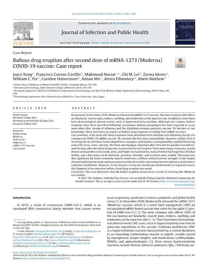 Elsevier – Bullous drug eruption after second dose of mRNA-1273 (Moderna) COVID-19 vaccine: Case report